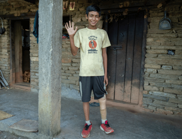 Sarbendra waving to the camera with a fitted prosthetic leg on