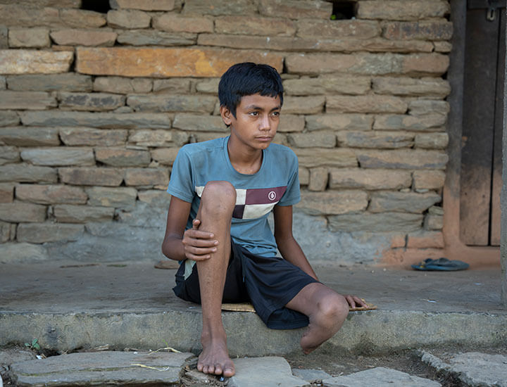 Boy looking out into the distance holding his leg